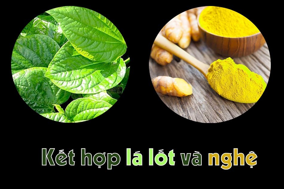 Kết hợp lá lốt và nghệ trị bệnh trĩ