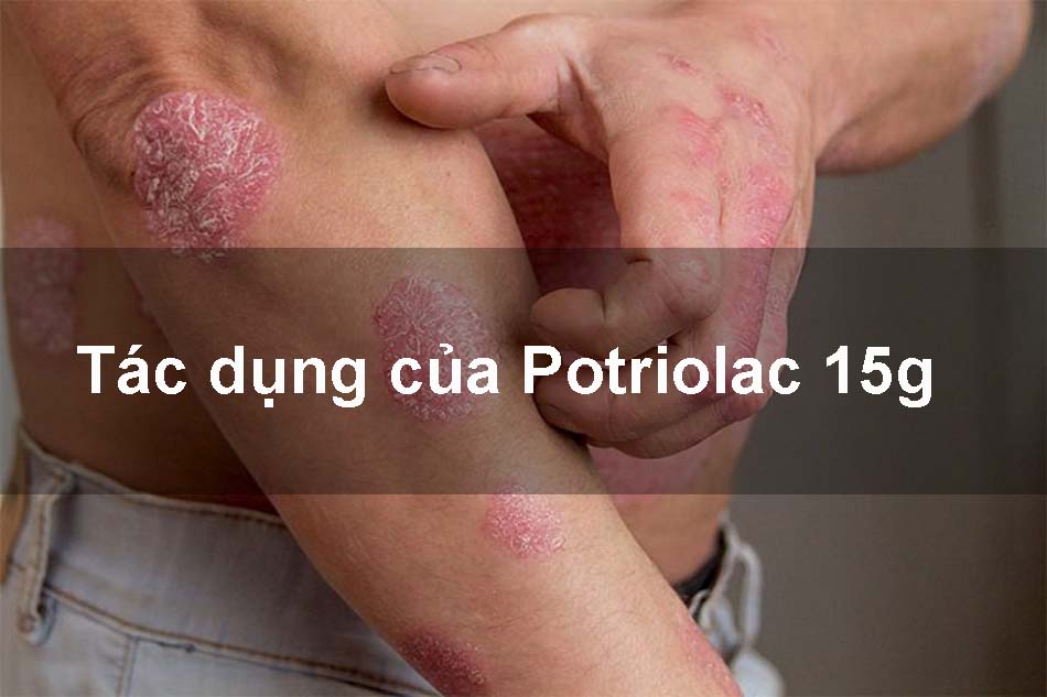 Tác dụng của thuốc Potriolac Gel 15g