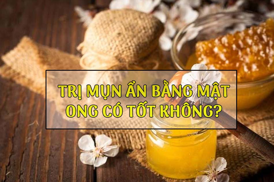 Trị mụn ẩn bằng mật ong có tốt không?