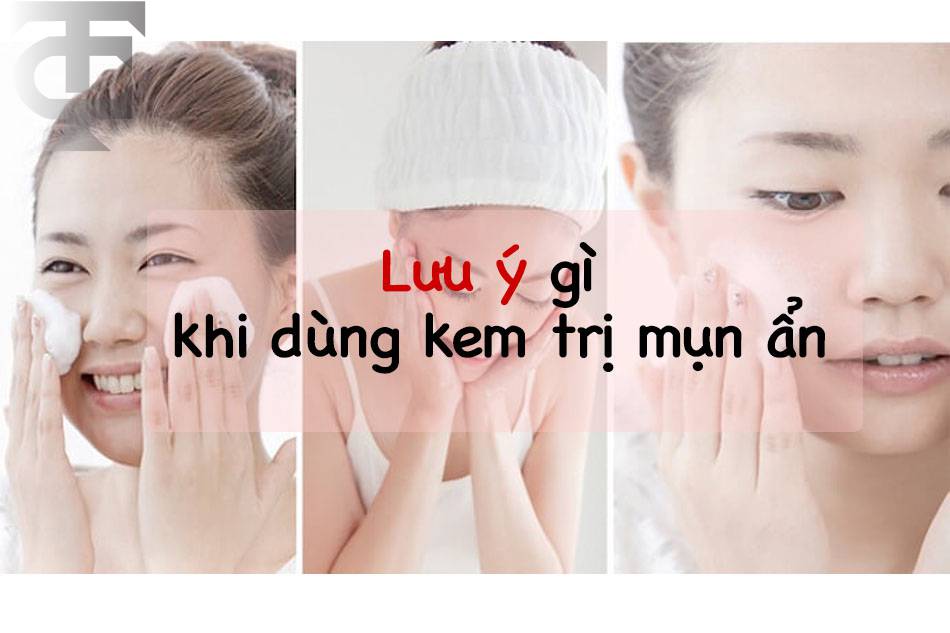 Những lưu ý khi sử dụng kem trị mụn ẩn