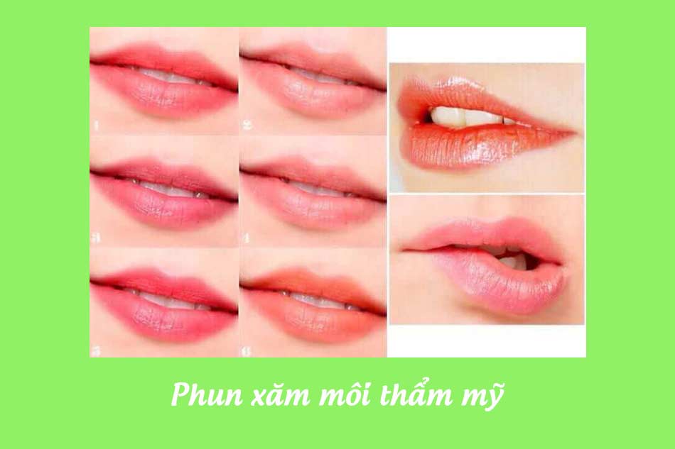 Thẩm mỹ viện Hoài Anh