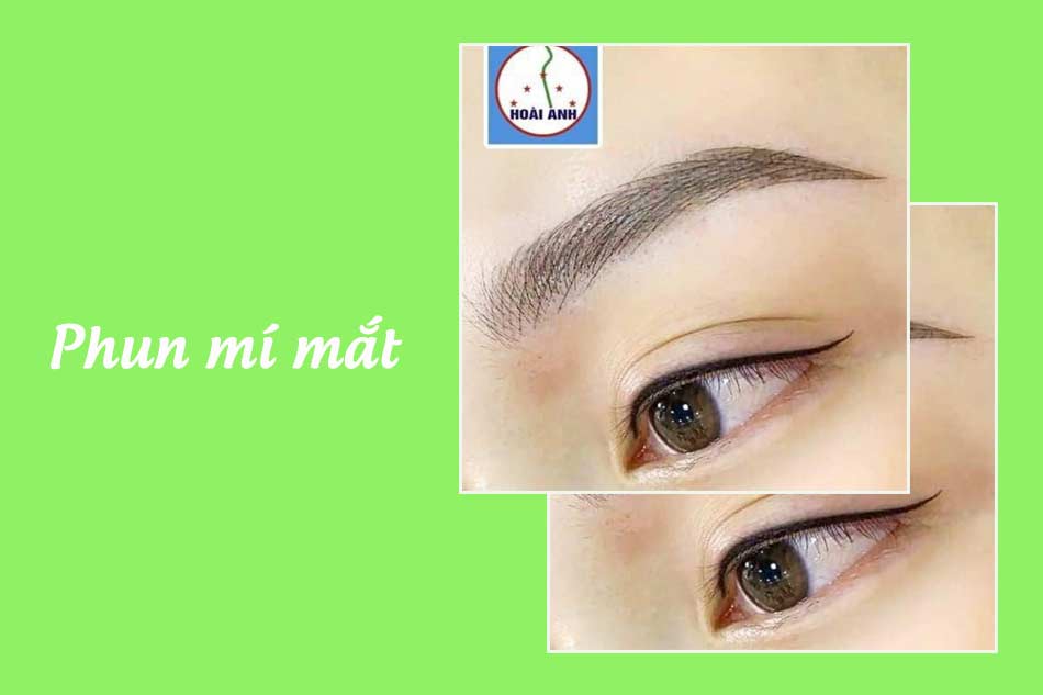 Thẩm mỹ viện Hoài Anh