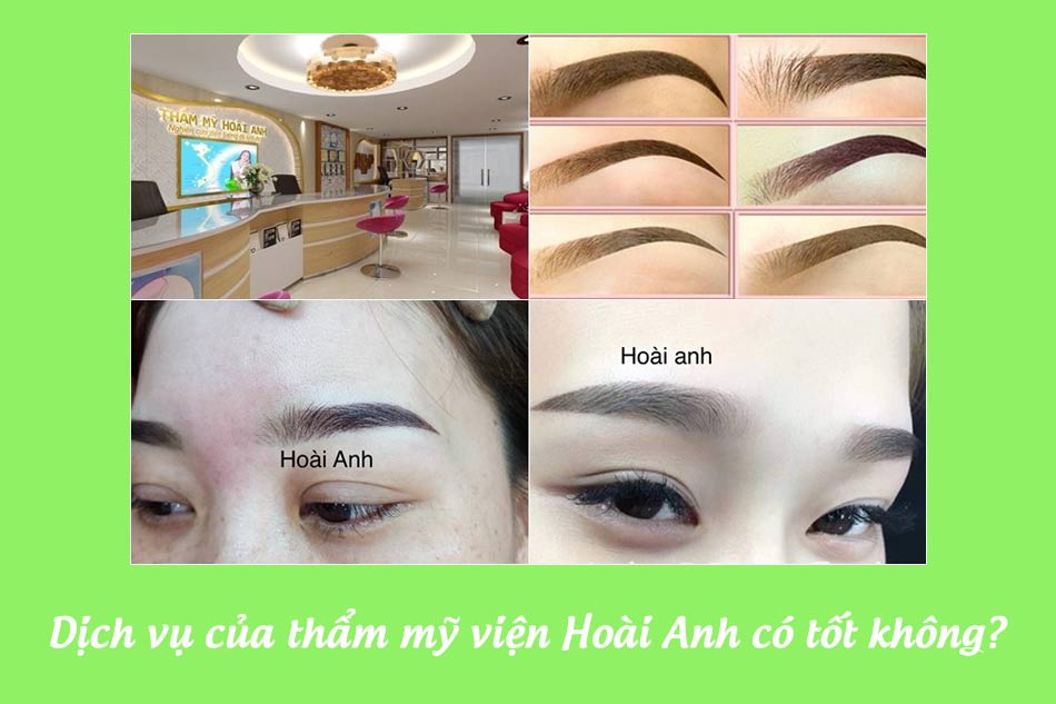 Thẩm mỹ viện Hoài Anh